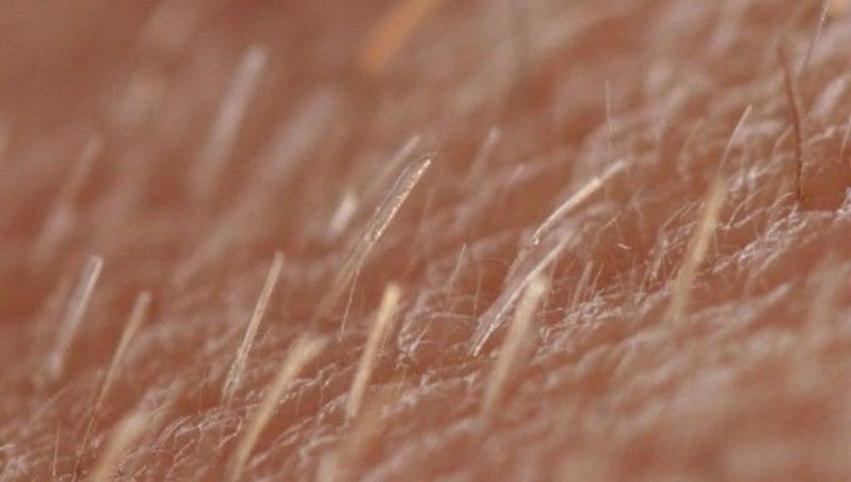 Lab Grown Skin Could Aid Our Understanding Of Skin Disorders IFLScience