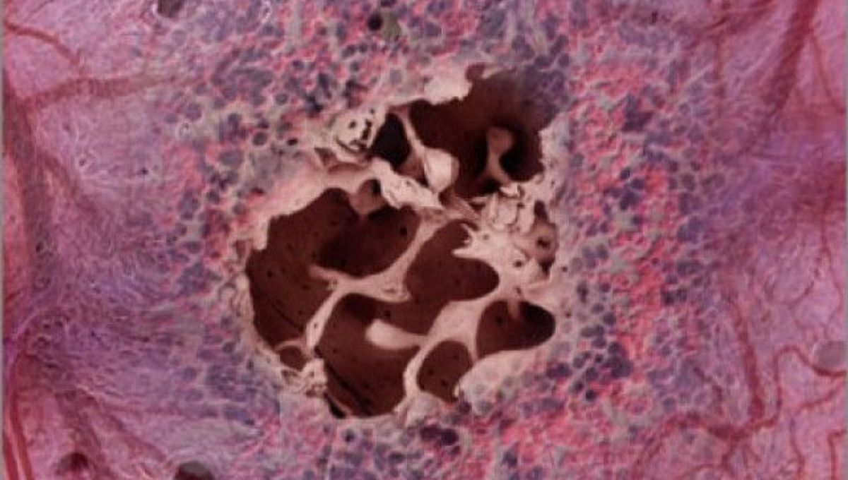 Scientists Engineer First Bone Marrow-On-A-Chip | IFLScience