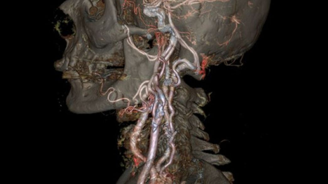 New CT Reveals Inner Structures of Body in Exquisite Detail | IFLScience