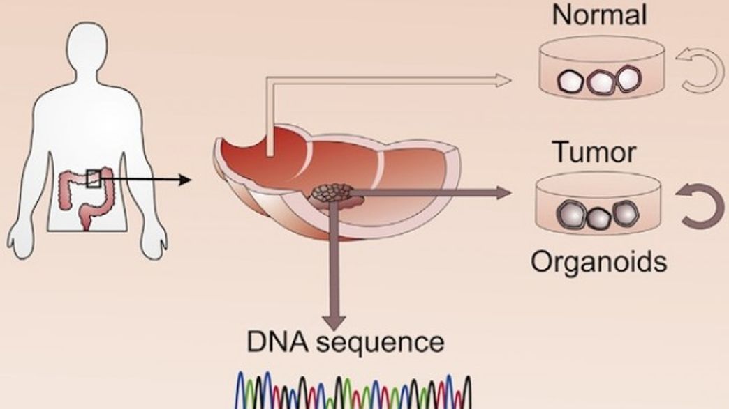 Mini Colons Grown in the Lab from Tumors | IFLScience