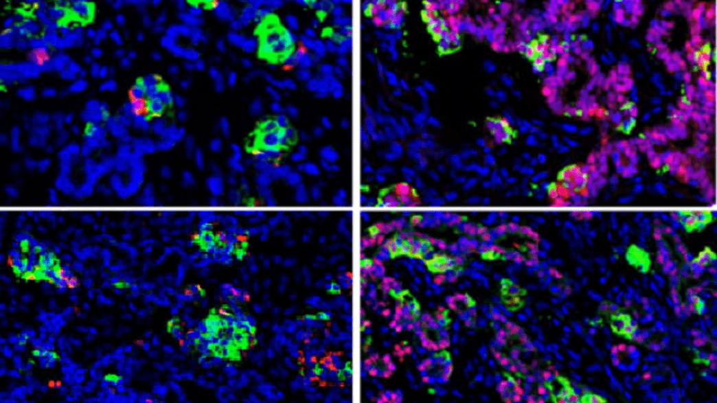 Researchers Have Made Insulin-Producing Cells From Human Skin Cells