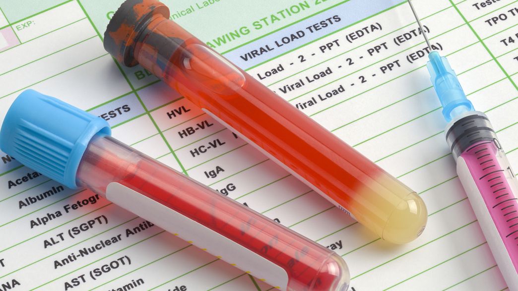 Can We Use A Simple Blood Test To Detect Cancer? IFLScience