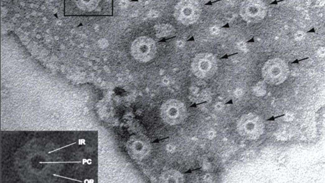 Pores On The Platypus Of Microbiology May Reveal How Complex Life Evolved