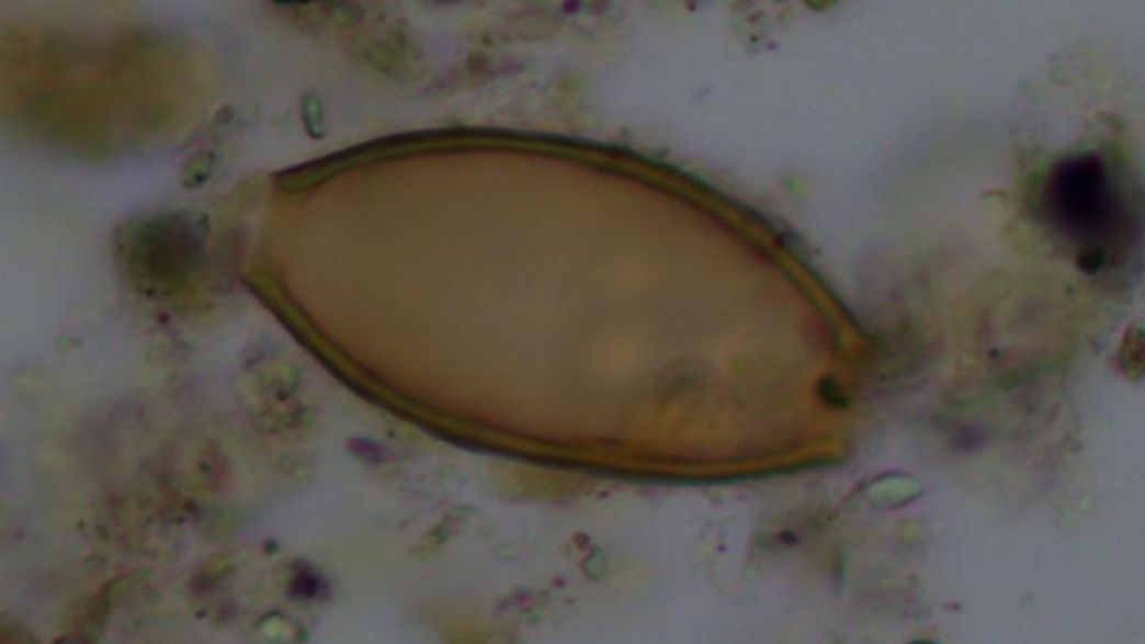 Analysis Of Ancient Greek Poop Finds Gut Parasites Described By