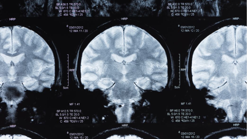 LowHum Therapy Seems To Counteract Alzheimer’s Symptoms In Mice