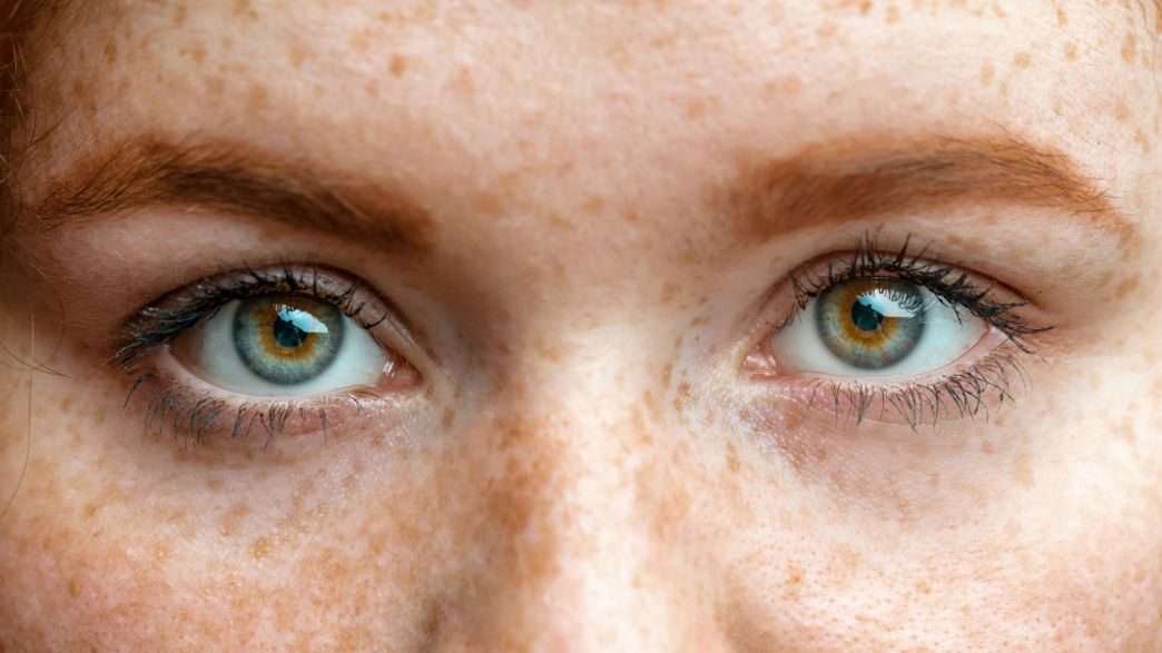 The Of Being Ginger Are More Complicated Than We Thought