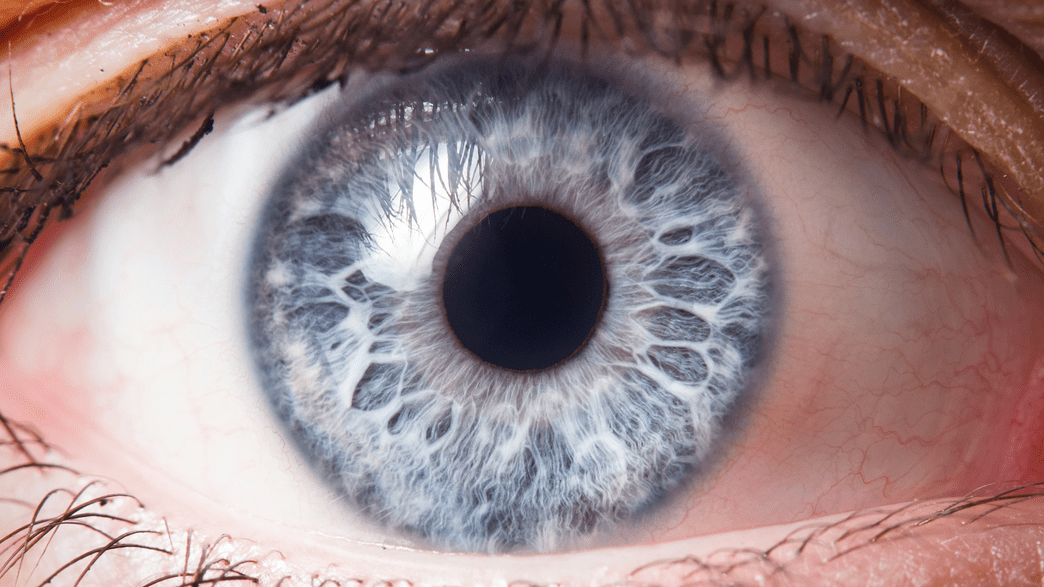 This Is What An Eye Looks Like With Half Its Iris Peeled Off | IFLScience - When Does Iris Get Out Of The Mirror