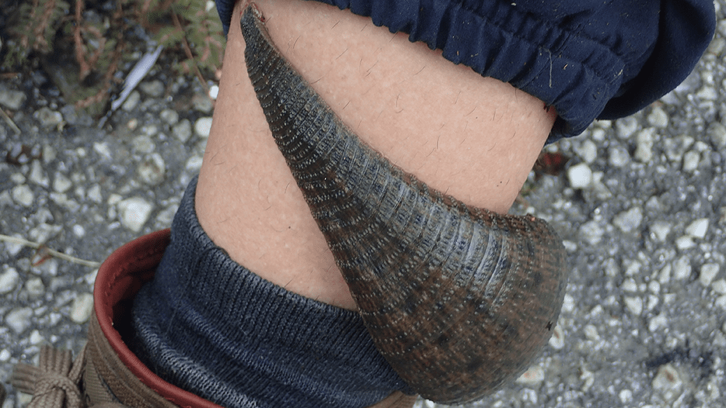 We Regret To Inform You That People Are Feeding Pet Leeches Their Own