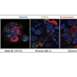Lung cells infected with variants of COVID-19 in a petri dish. Solutions with even tiny quantities of three biological molecules showed almost no infection