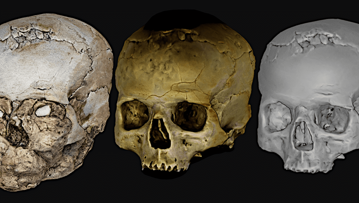 Forensics reveals long-lost face of shell-eyed ‘Jericho skull’