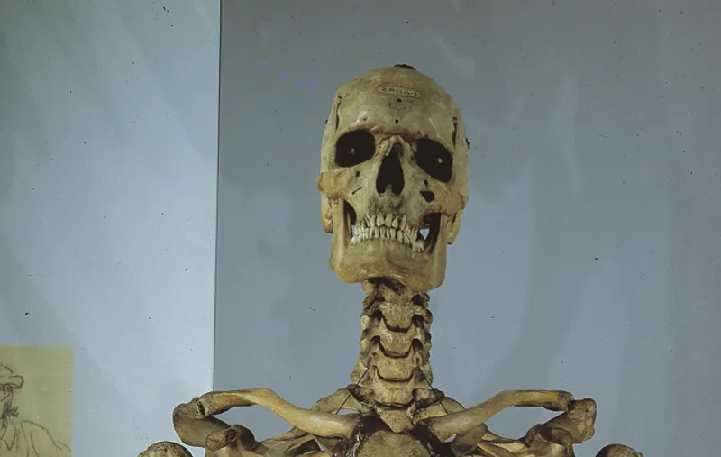 skeleton of Charles Byrne