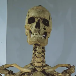 skeleton of Charles Byrne