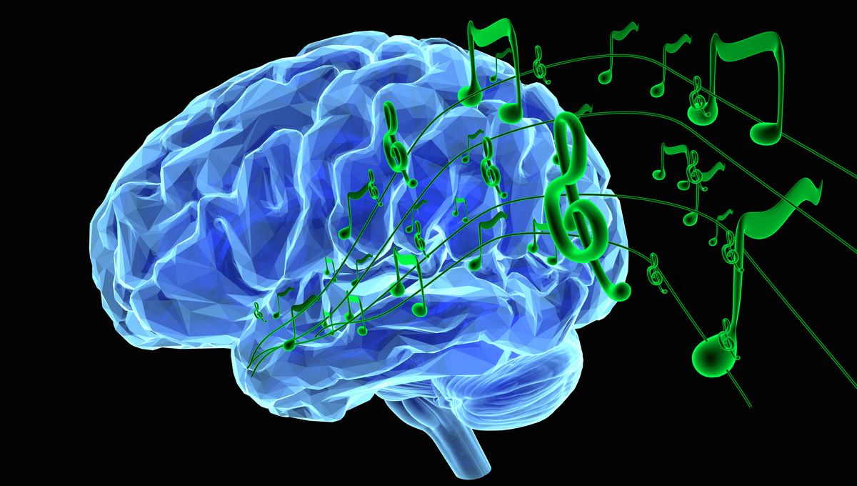Brain Musili Brain Activity Translated Into Snippets Of Classic Rock Song In ...