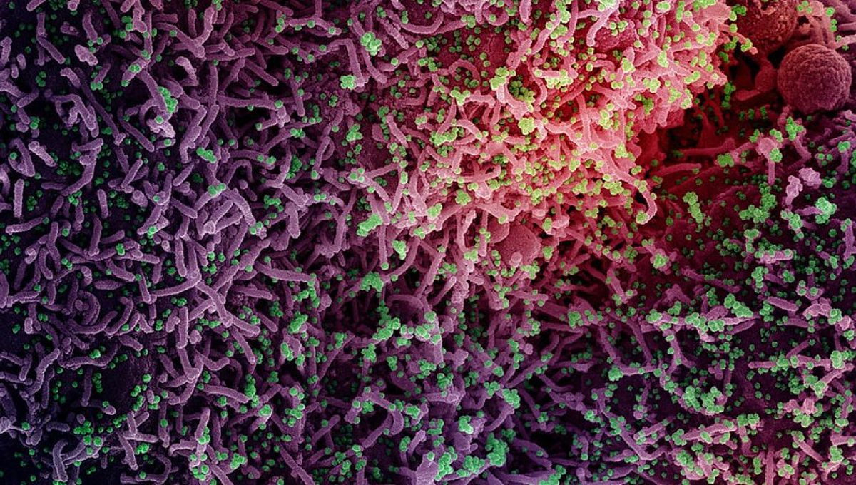 What Was The First Virus Discovered By Science? | IFLScience