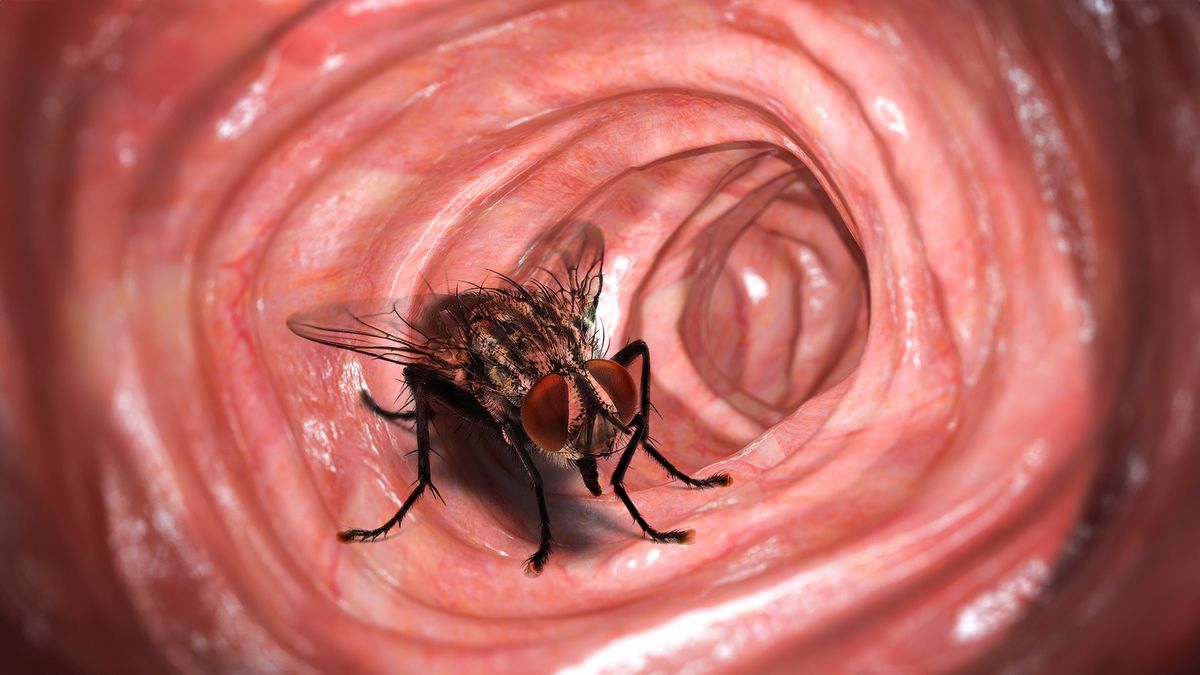 Mystery After Completely Intact Fly Found Inside Man's Colon