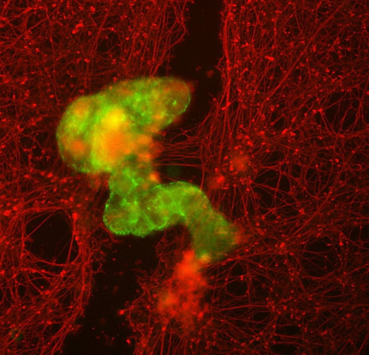 These Tiny‚ Wound-Healing Robots Start Life As Just 1 Human Cell
