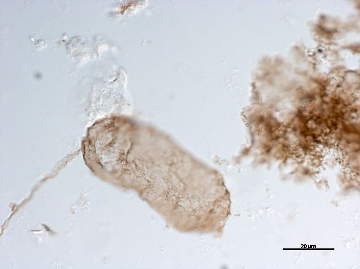 1.75-Billion-Year-Old Fossilized Cells Are Oldest Evidence For Photosynthesis In Cyanobacteria