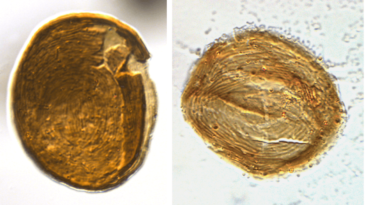200-Million-Year-Old “Problematic” Microfossils Finally Identified‚ And They’re Super Weird