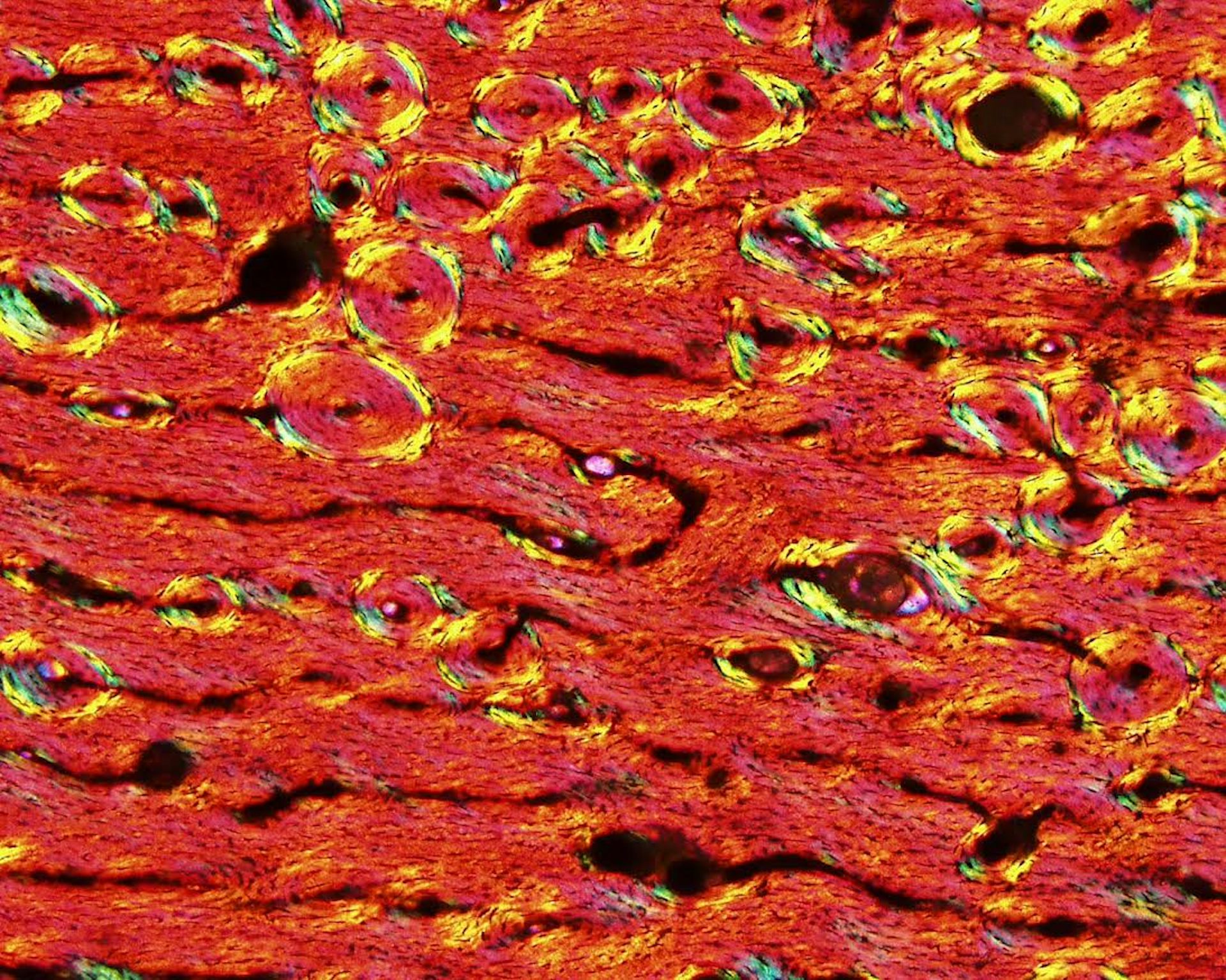 A thin slice of a juvenile titanosaur femur bone. A thin slice of a juvenile titanosaur femur bone.