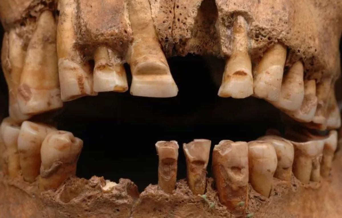 Vikings May Have Modified Their Teeth As A Kind Of Initiation