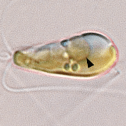 A light microscopy image shows the marine haptophyte algae Braarudosphaera bigelowii with a black arrow pointing to the nitroplast organelle