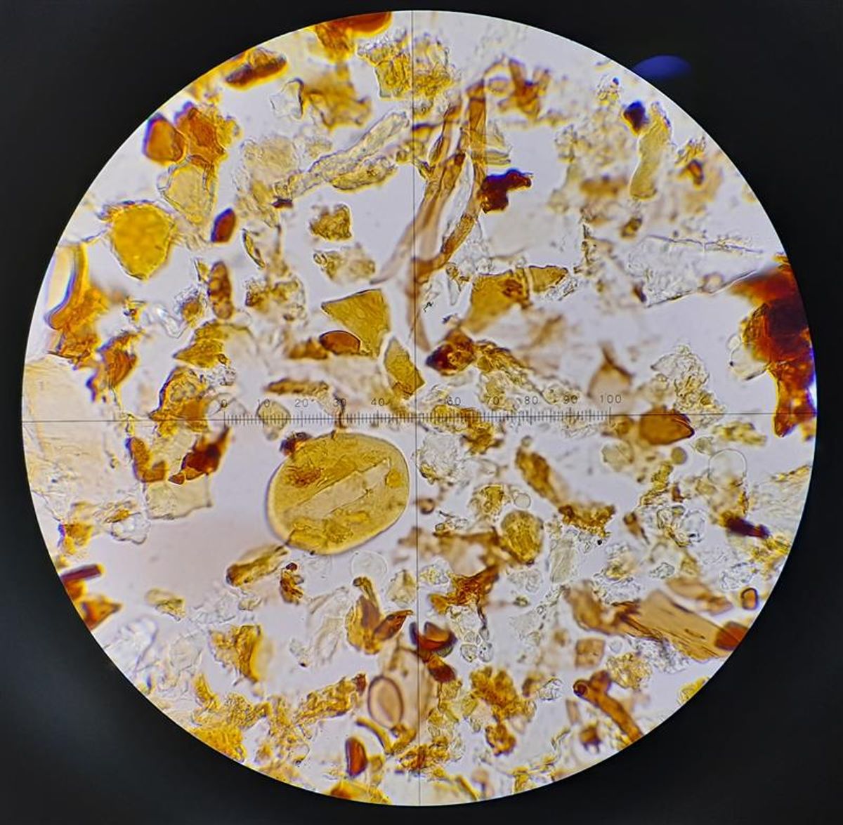 New Machine Learning Technique May Revolutionize Research Into 500 Million-Year-Old Microfossils