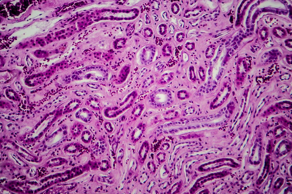 New Immune Pathway Discovery Points To Future “Potential Cure” For Lupus