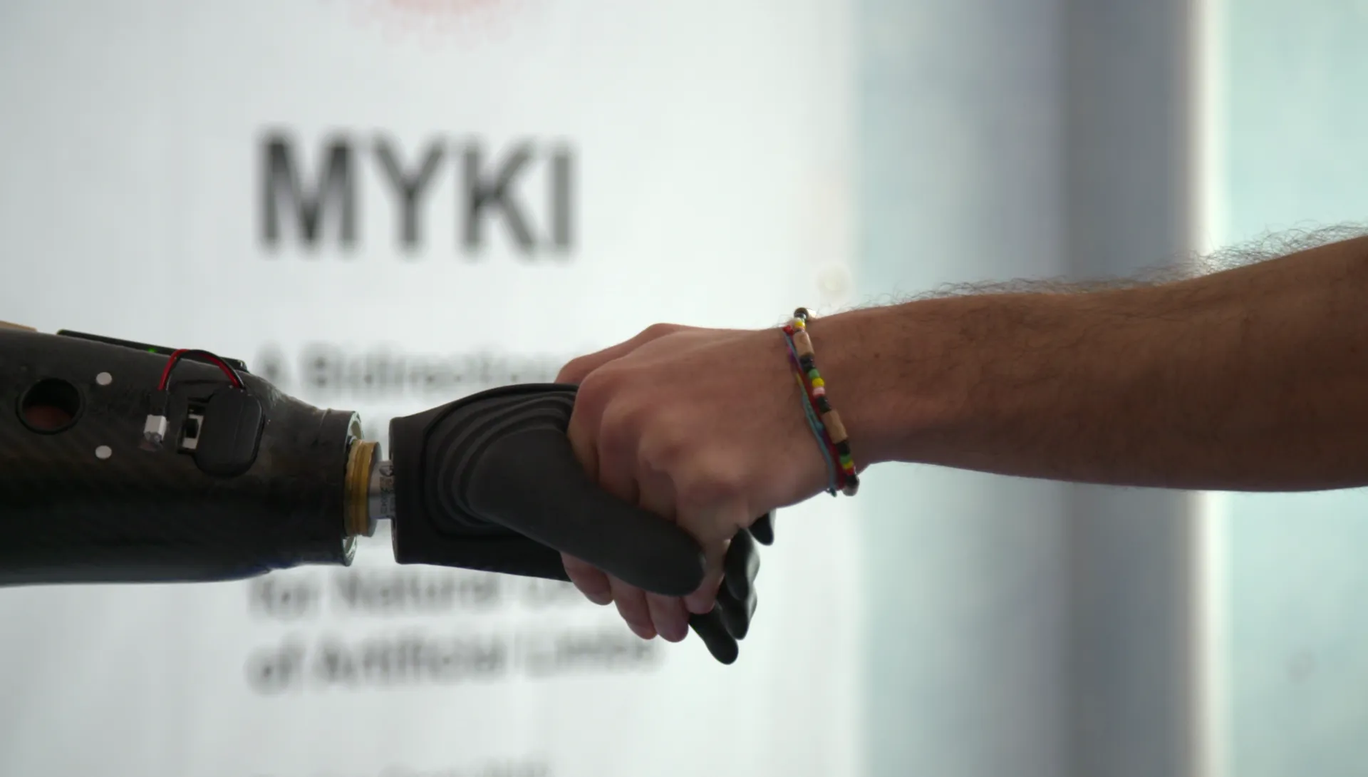 First Magnet-Controlled Prosthetic Hand Allows Amputee To Move