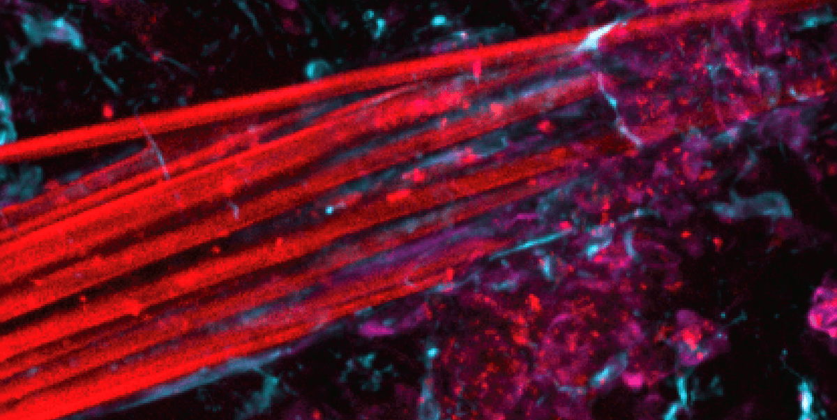 New Flexible, Noodle-Like Electrodes Offer Damage-Free Brain Activity Recording