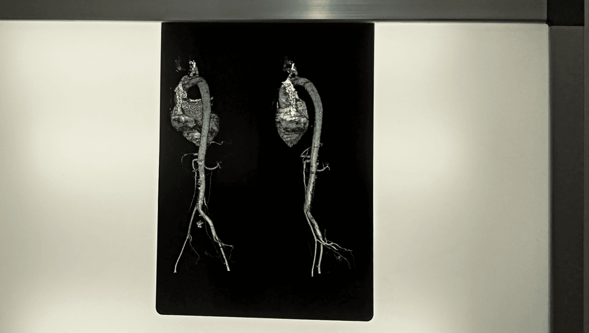 Organs Age At Different Rates And Communicate Via Secreted Proteins, Marking New Targets For Aging Research