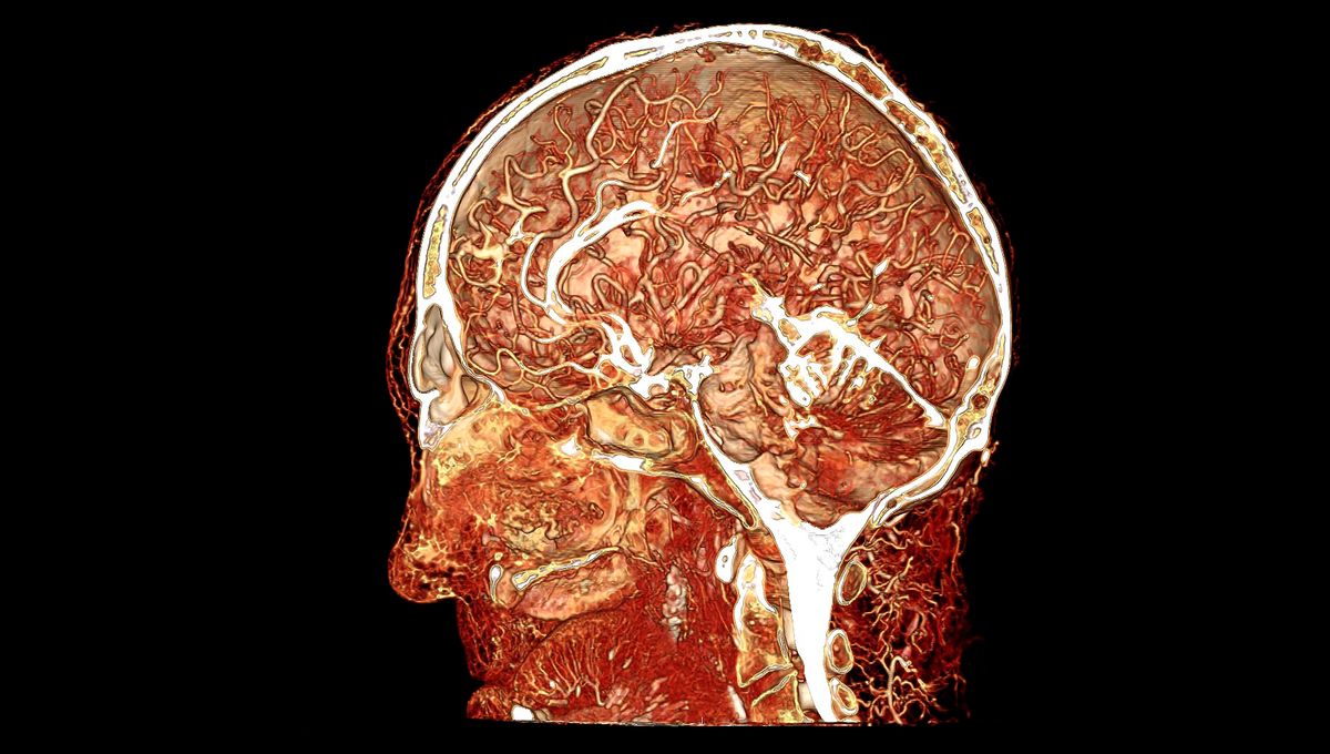 New Whole-Brain Organoids With Blood Vessels Achieve 80 Percent ...