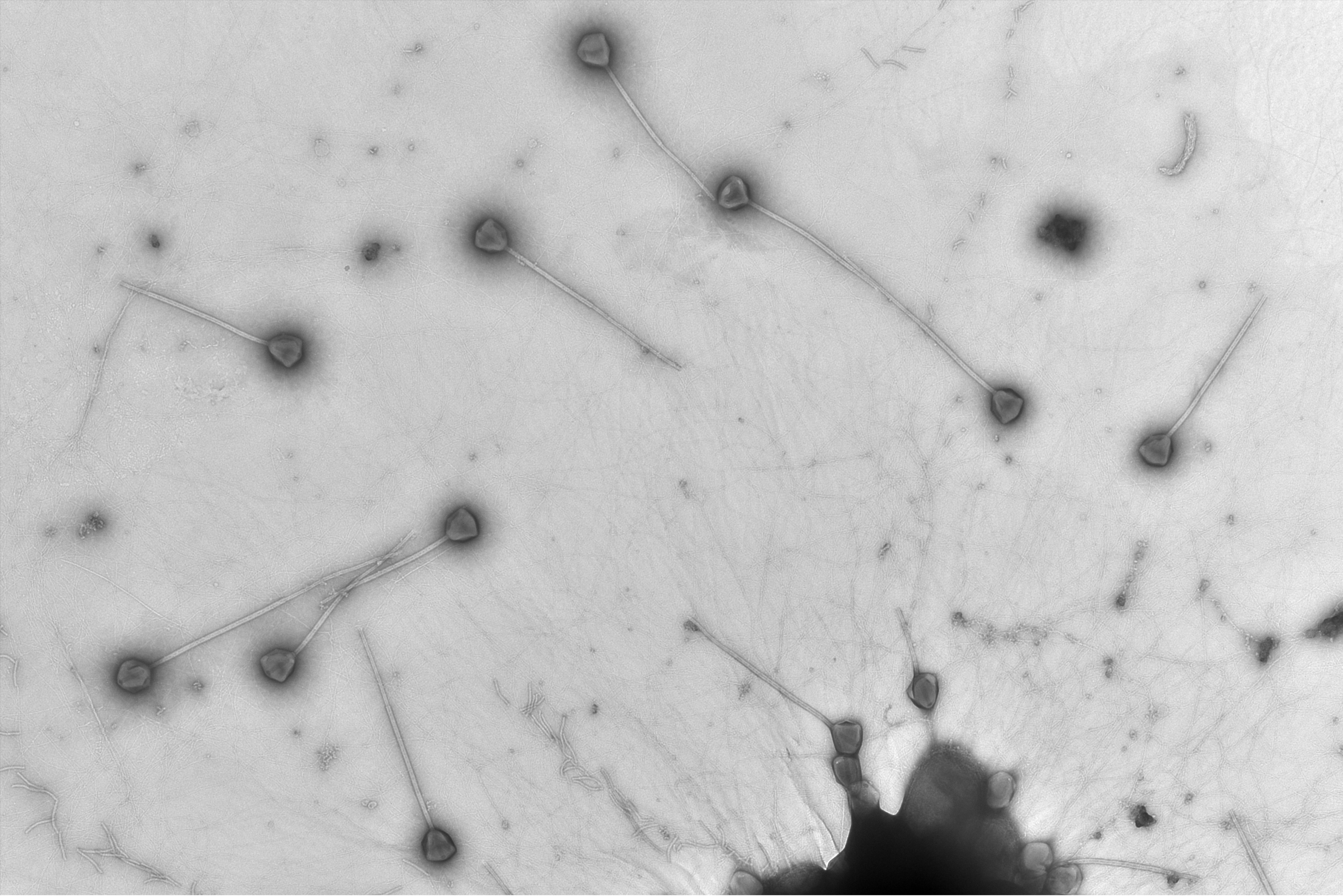 micrograph with lots of viruses with long straight tails