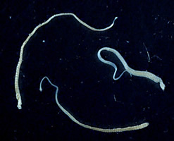 Adult dwarf tapeworm