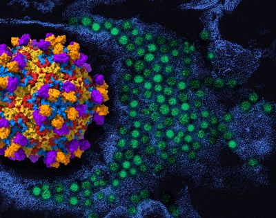 On the left is a 3D rendering of enterovirus D68 (viral proteins are colored red, yellow, blue) with human monoclonal antibody EV68-228 (orange/purple); to the right of it/in the background is a colorized transmission electron micrograph of enterovirus D68 virus particles (colored in green). 3D rendering by NIAID; micrograph, which has been repositioned and recolored by NIAID, is courtesy of CDC