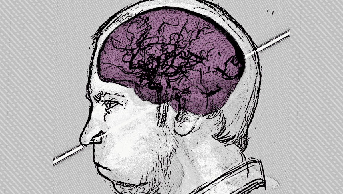 Physicist Anatoli Bugorski Survived A Proton Beam Through The Head – New 3D Reconstruction Reveals How