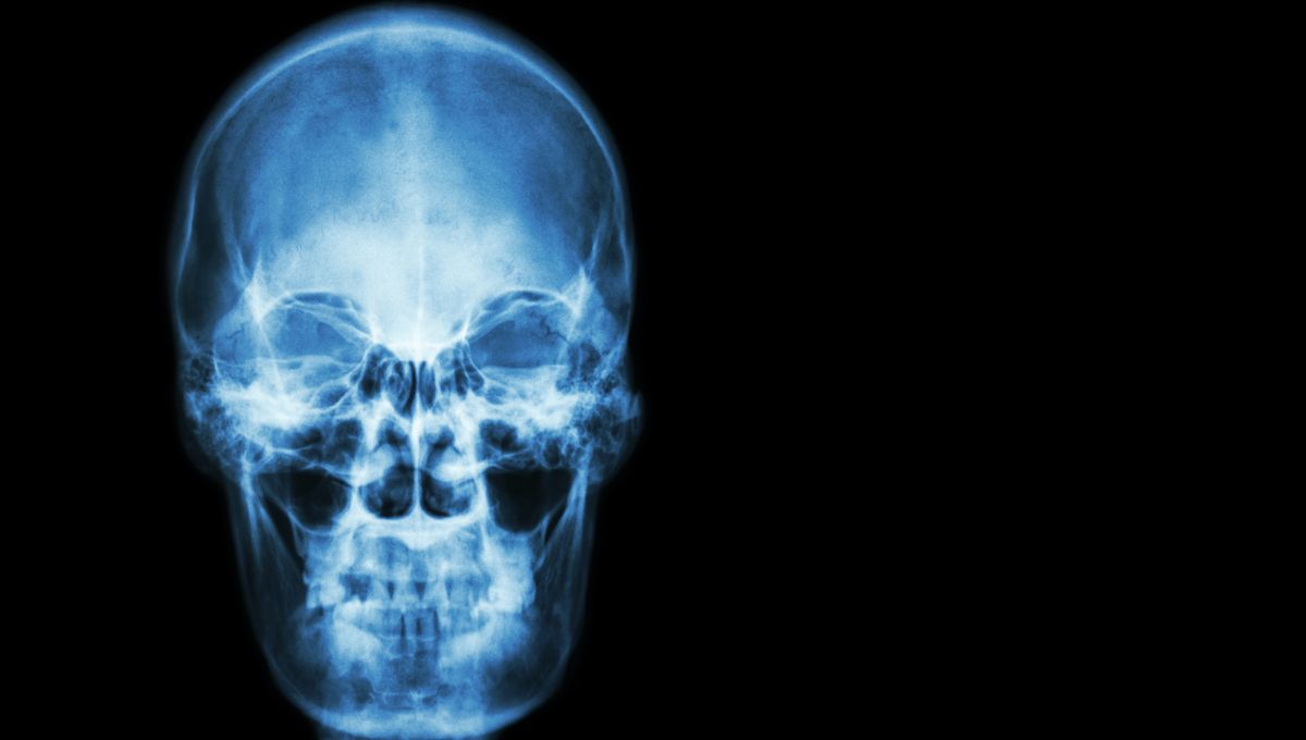 “Snap, Crackle, And Pop”: A Man Covered His Nose While He Sneezed And Punctured His Windpipe