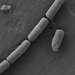 iflscience.com - Dr. Etelka Chung - Living Cement: The Microbes In Your Walls Could Power The Future