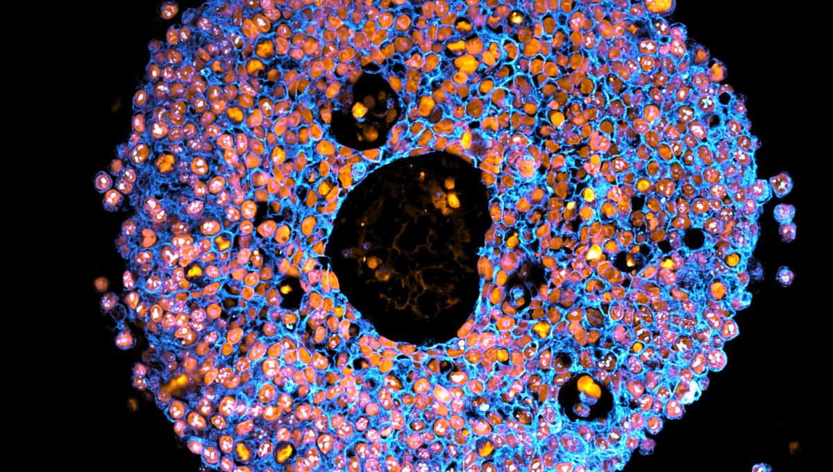 Ilmuwan Berhasil 3D Bioprinting Plasenta Miniatur untuk Riset Kehamilan