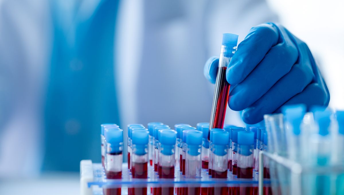 Tes Darah Baru Berpotensi Permudah Diagnosa ME/CFS, Namun Masih Dipertanyakan