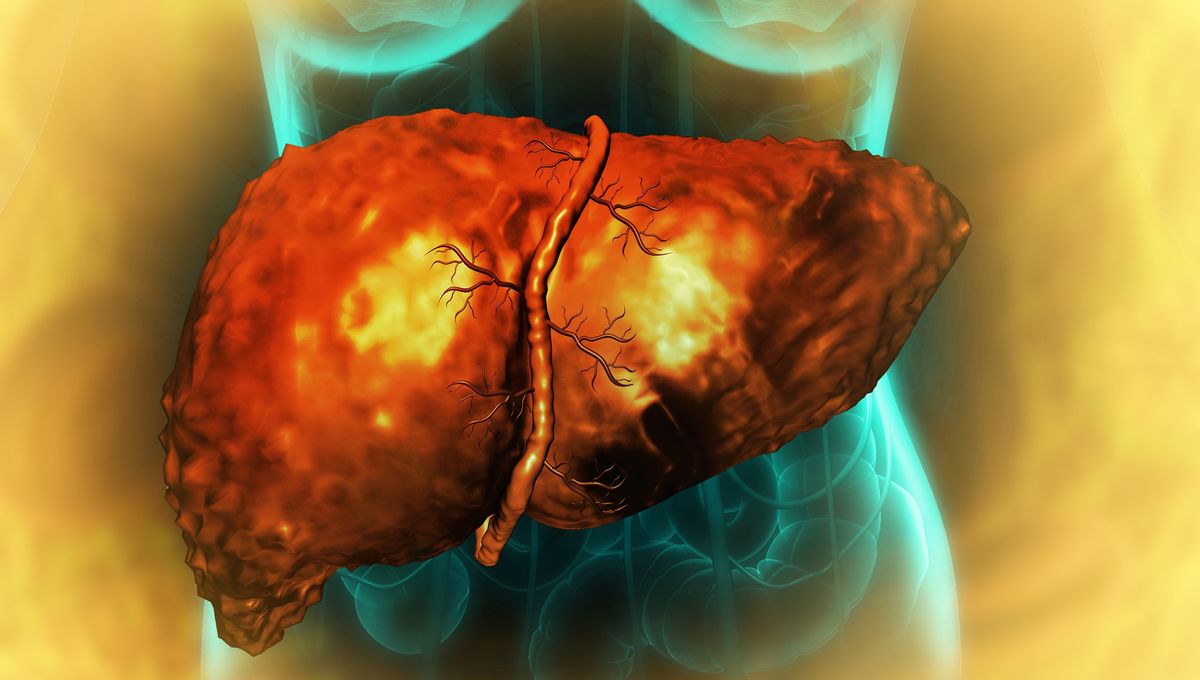 Ekstrak Tanaman Henna: Pengobatan Mengejutkan untuk Fibrosis Hati Ekstrak Tanaman Henna: Pengobatan Mengejutkan untuk Fibrosis Hati