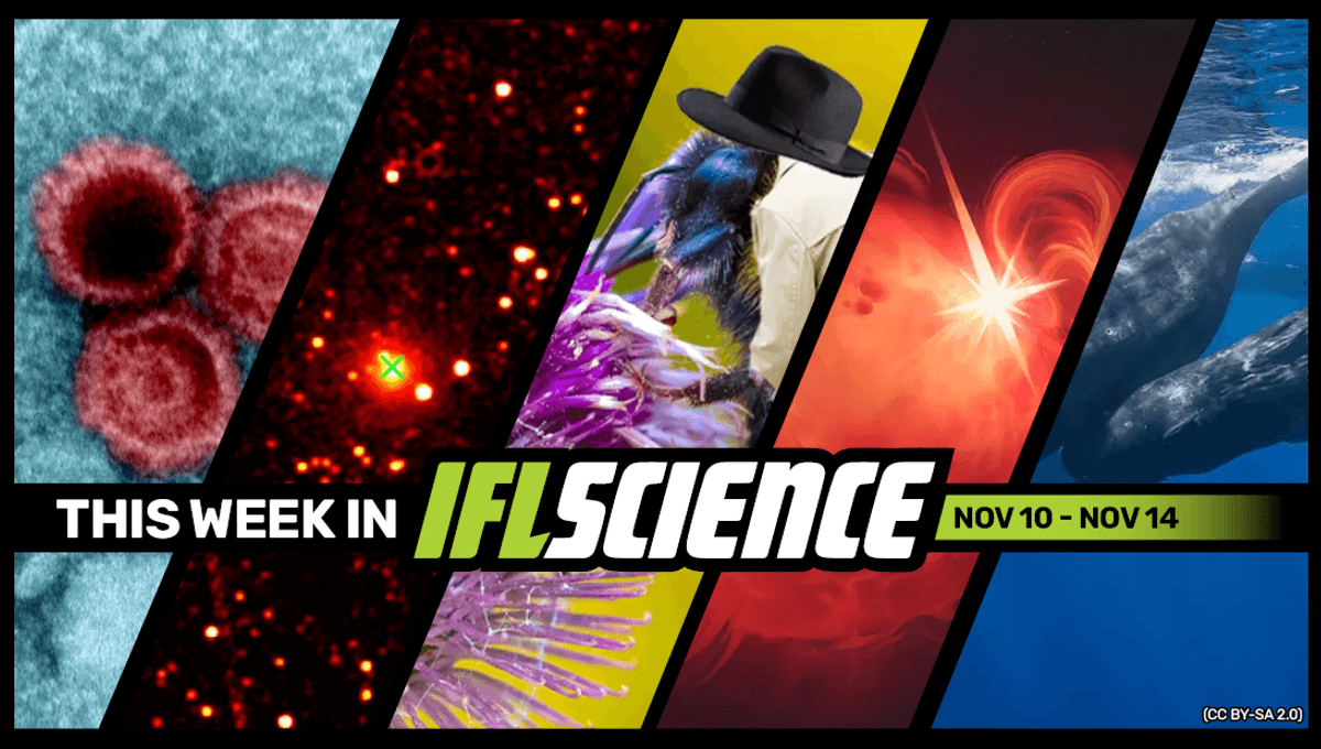 Lupus Terkait Virus Umum, Deteksi Radio dari Objek Antarbintang