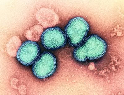 Influenza A Virus (H3N2), colorize microscope images with the circular virus particles appearing a turquoise color against a pink background