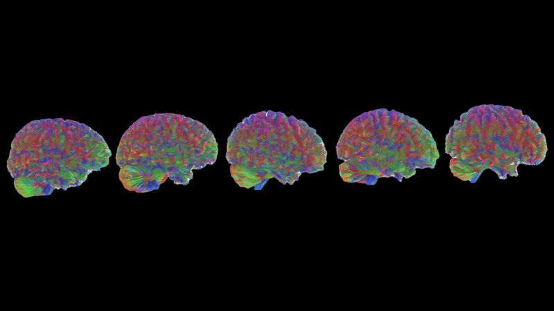 MRI tractography images of the five stages of brain age: childhood, adolescence, adulthood, early aging, and late aging.