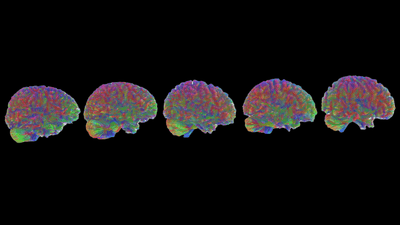 MRI tractography images of the five stages of brain age: childhood, adolescence, adulthood, early aging, and late aging.