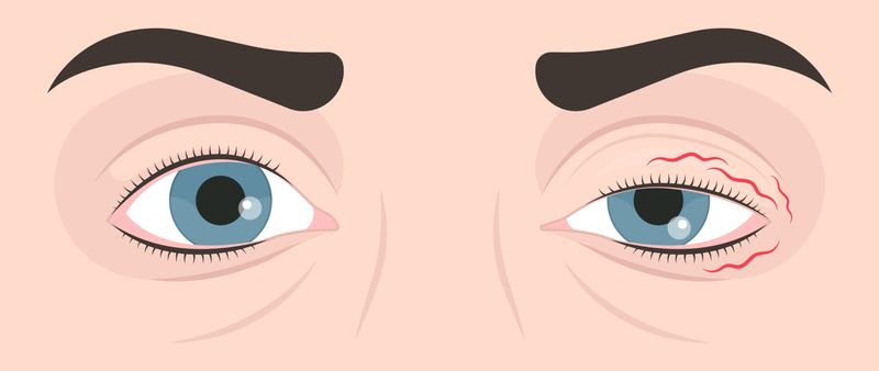 cartoon close up of eyes with one eyelid half closed
