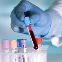 hands of a lab technician holding a tube of blood above a rack with other samples