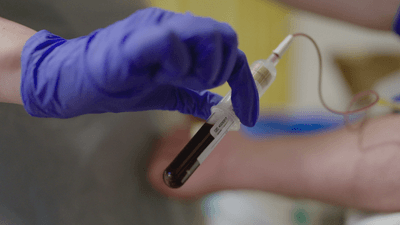 a biomarker blood test searches for molecular postcodes of cancer