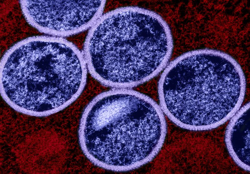 Colorized transmission electron micrograph of immature mpox virus particles (purple) found within an infected VERO E6 cell (red). Image captured at the NIAID Integrated Research Facility (IRF) in Fort Detrick, Maryland