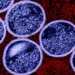 Colorized transmission electron micrograph of immature mpox virus particles (purple) found within an infected VERO E6 cell (red). Image captured at the NIAID Integrated Research Facility (IRF) in Fort Detrick, Maryland