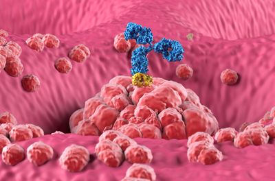 3D illustration depicting monoclonal antibody treatment in Stomach cancer (gastric)